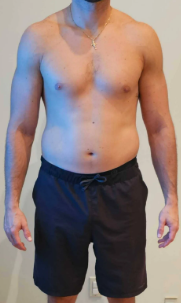 THINNR Protocol (61 Days)  — before