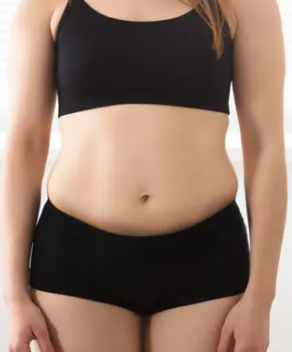 GLP1 Tirzepitide (7 Months)  — before