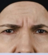 Letybo — before