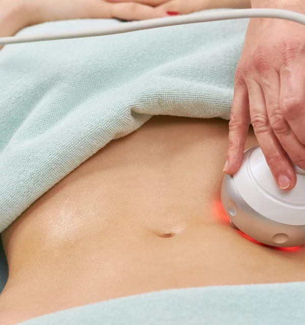 Lipo Laser in Clinton Twp, MI