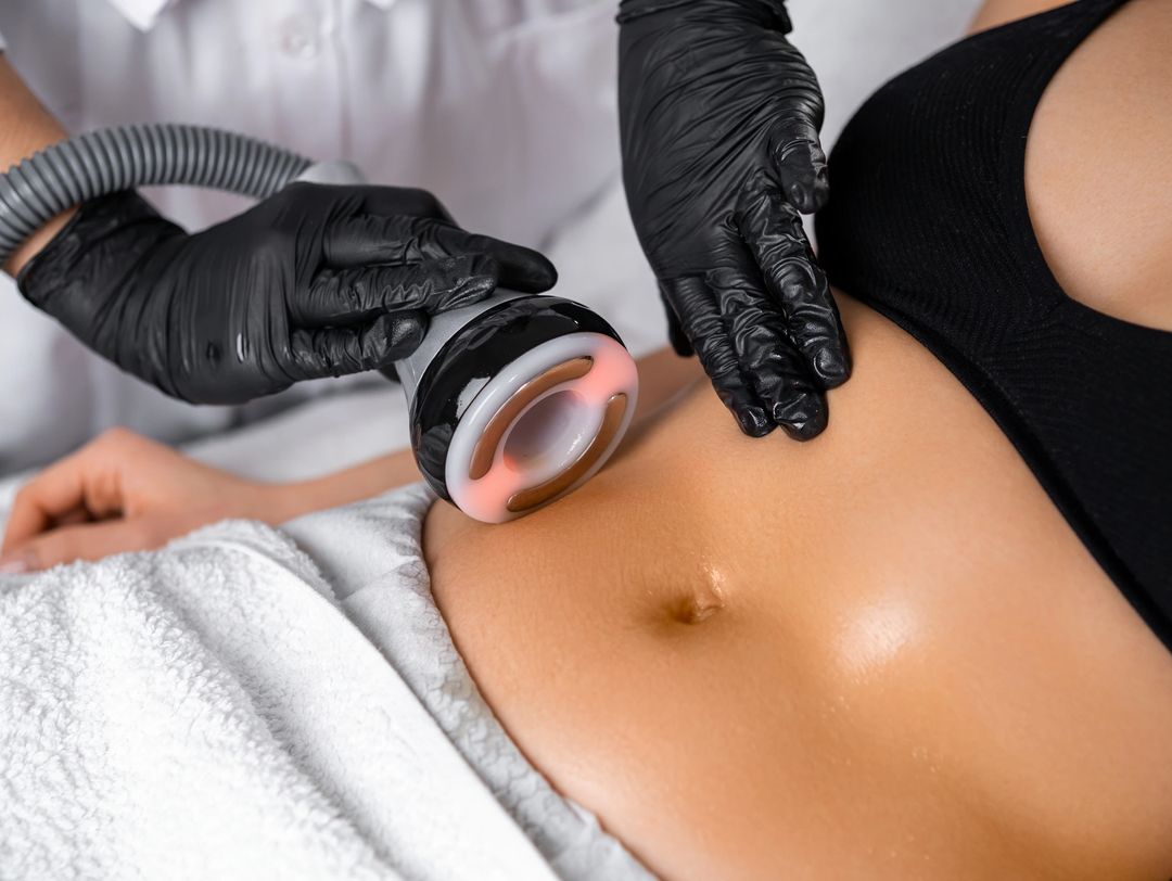 Body Sculpting