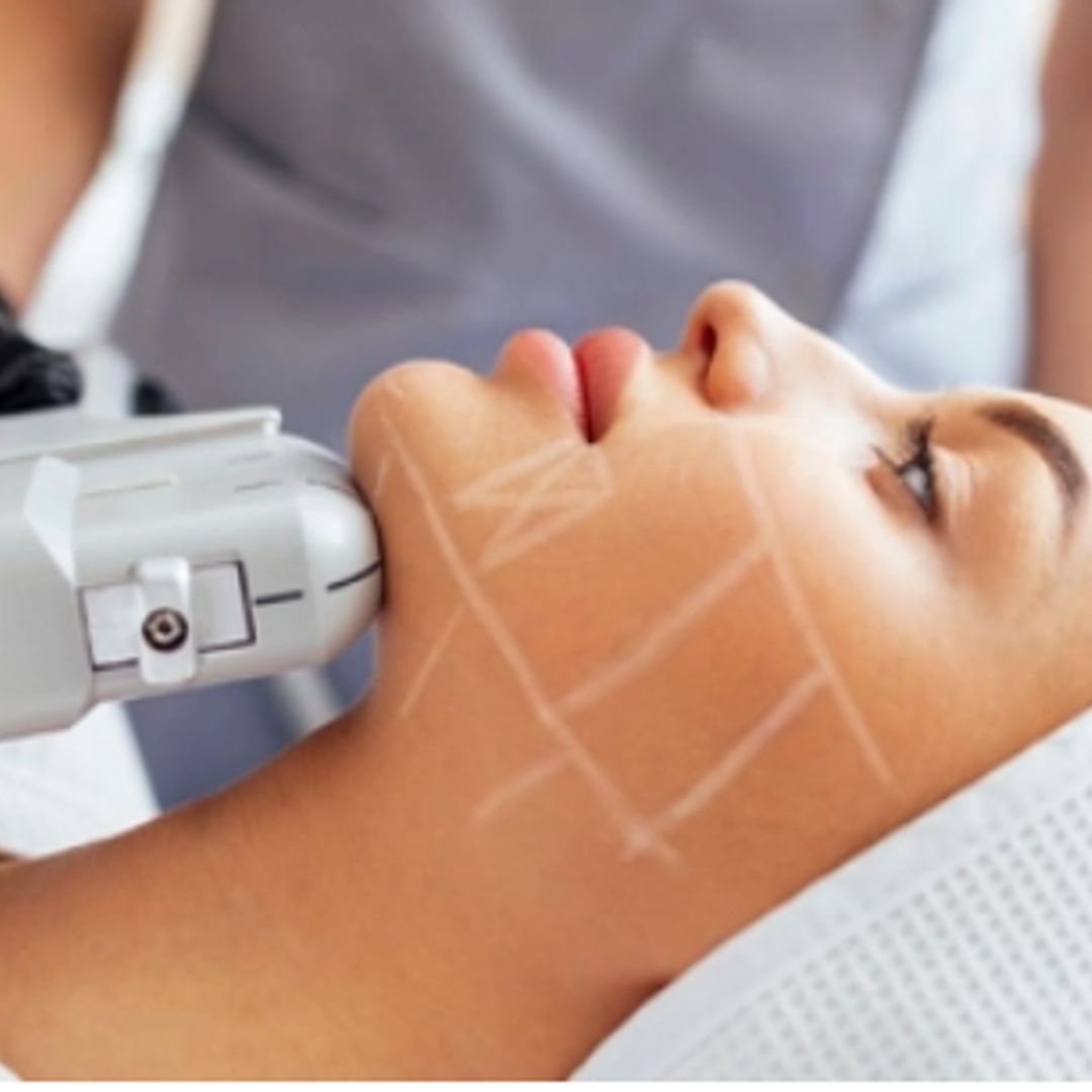 HIFU Skin Tightening