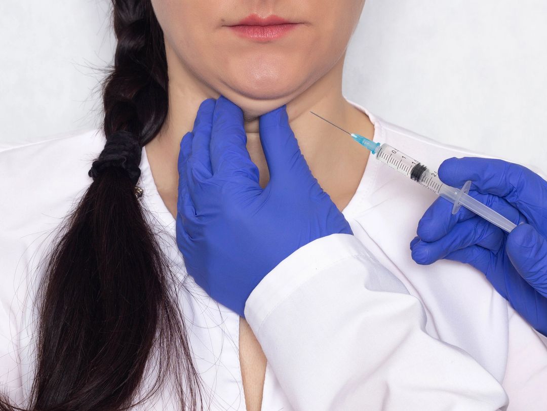 Kybella