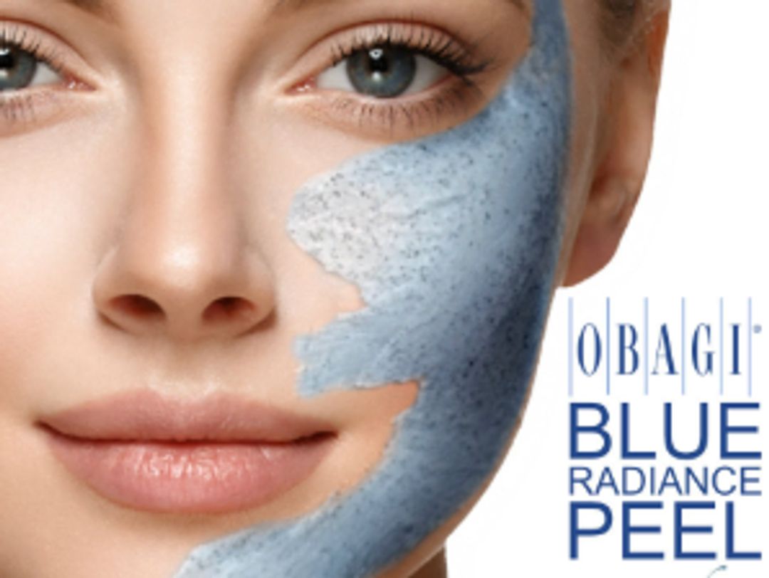 Chemical Peels