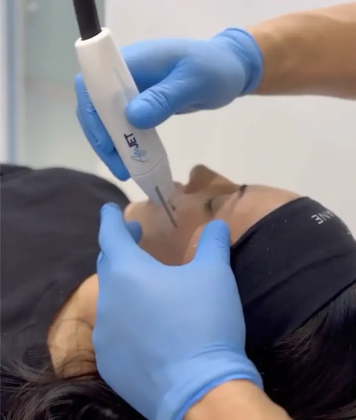 AgeJet-PlasmaTreatment-in-Clinton-TWP-MI