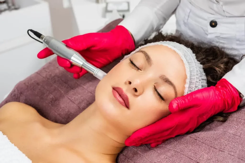 Microneedling by Iridescent Medical and Wellness Spa in Clinton Twp, MI
