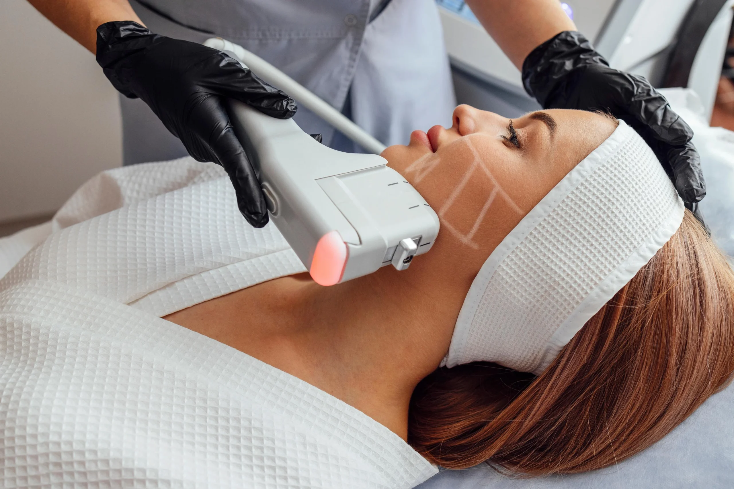 HIFU at Iridescent Medical and Wellness Spa in Clinton Twp, MI