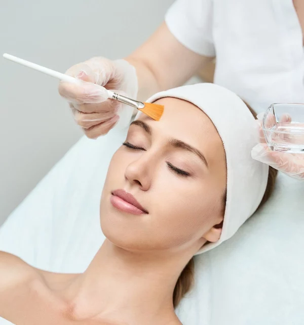 Chemical Peels in Clinton Twp, MI